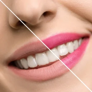 Rouge à Lèvres Fleur Fraise - Inuwet